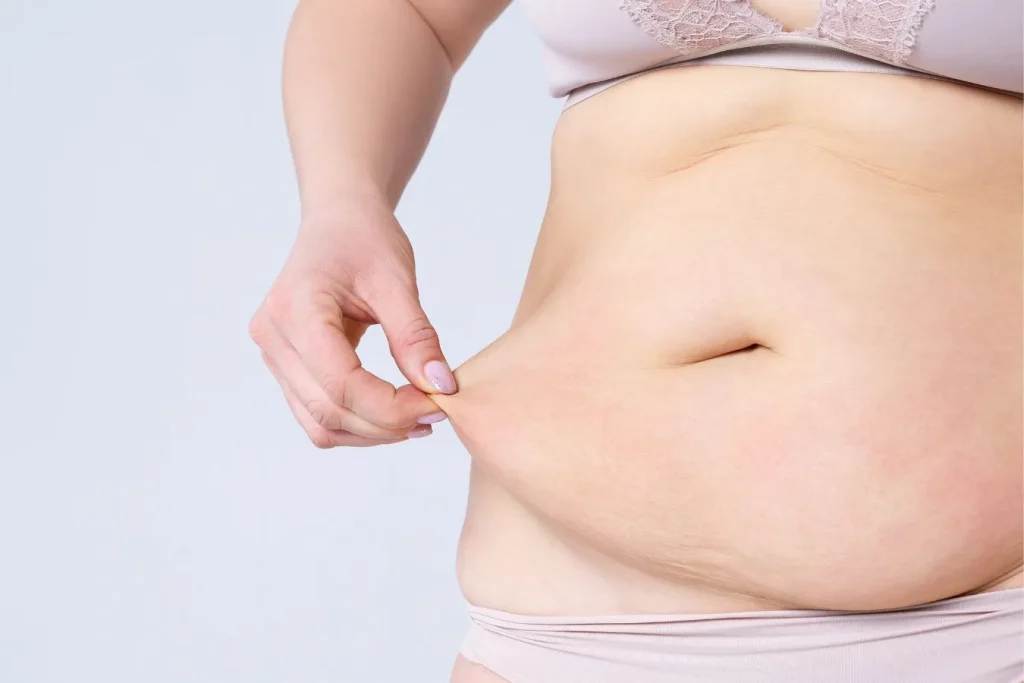 Pourquoi la perte de poids peut-elle &ecirc;tre diff&eacute;rente apr&egrave;s une c&eacute;sarienne