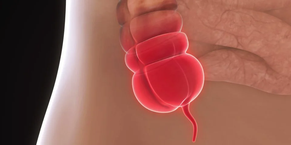 Pourquoi peut-on perdre du poids apr&egrave;s une appendicite