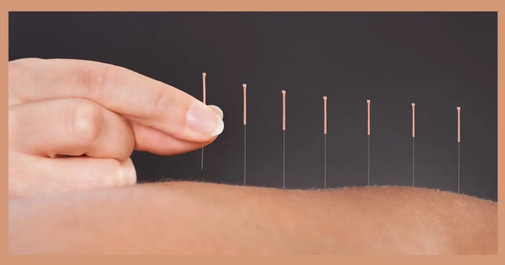 digipuncture et acupuncture pour perdre du poids