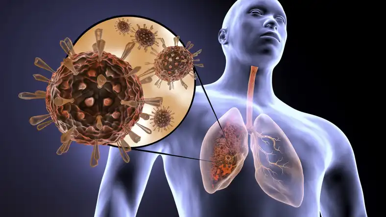 Infections chroniques