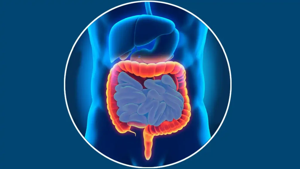 Maladies inflammatoires chroniques de l&rsquo;intestin